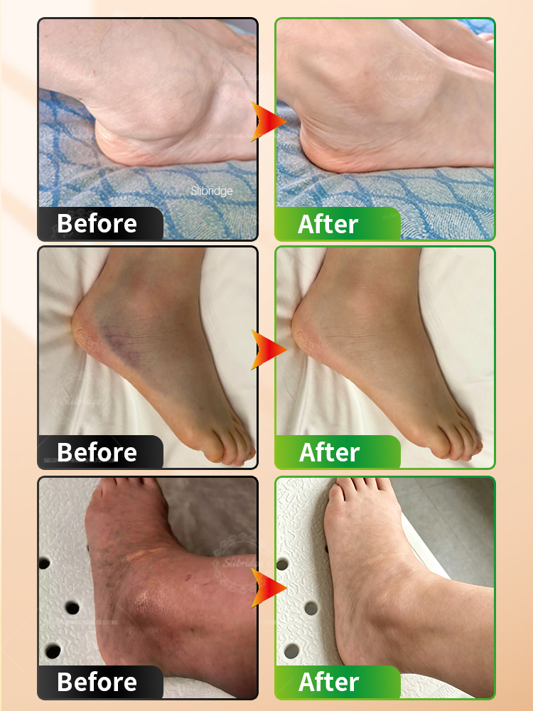 Portable Heated Ankle Massager - đánh giá và giá Ankle Mobility Band